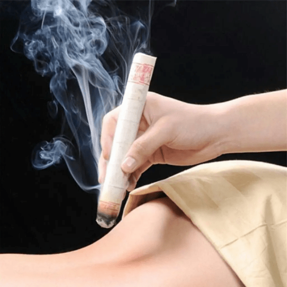 moxibustion